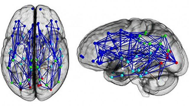 cerebro masculino