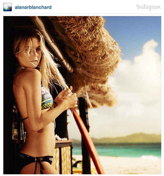 65-alana-blanchard