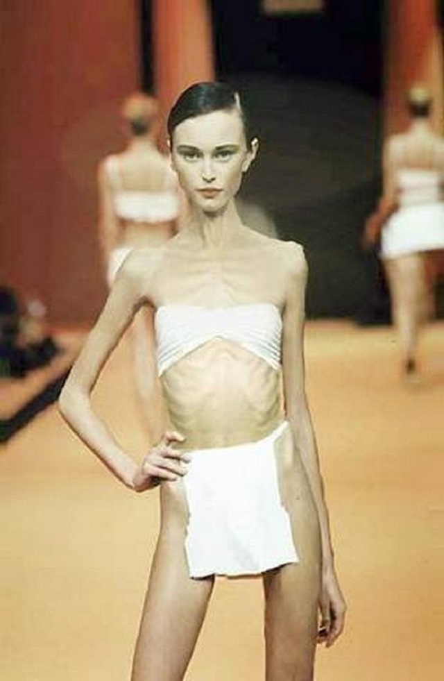 anorexic-models-23