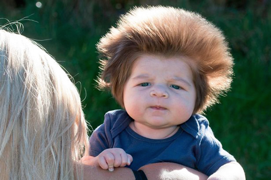 Junior Cox-Noon, el niño con mucho cabello