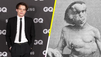 Critican a la BBC por no contratar a un actor discapacitado para ‘The Elephant Man’