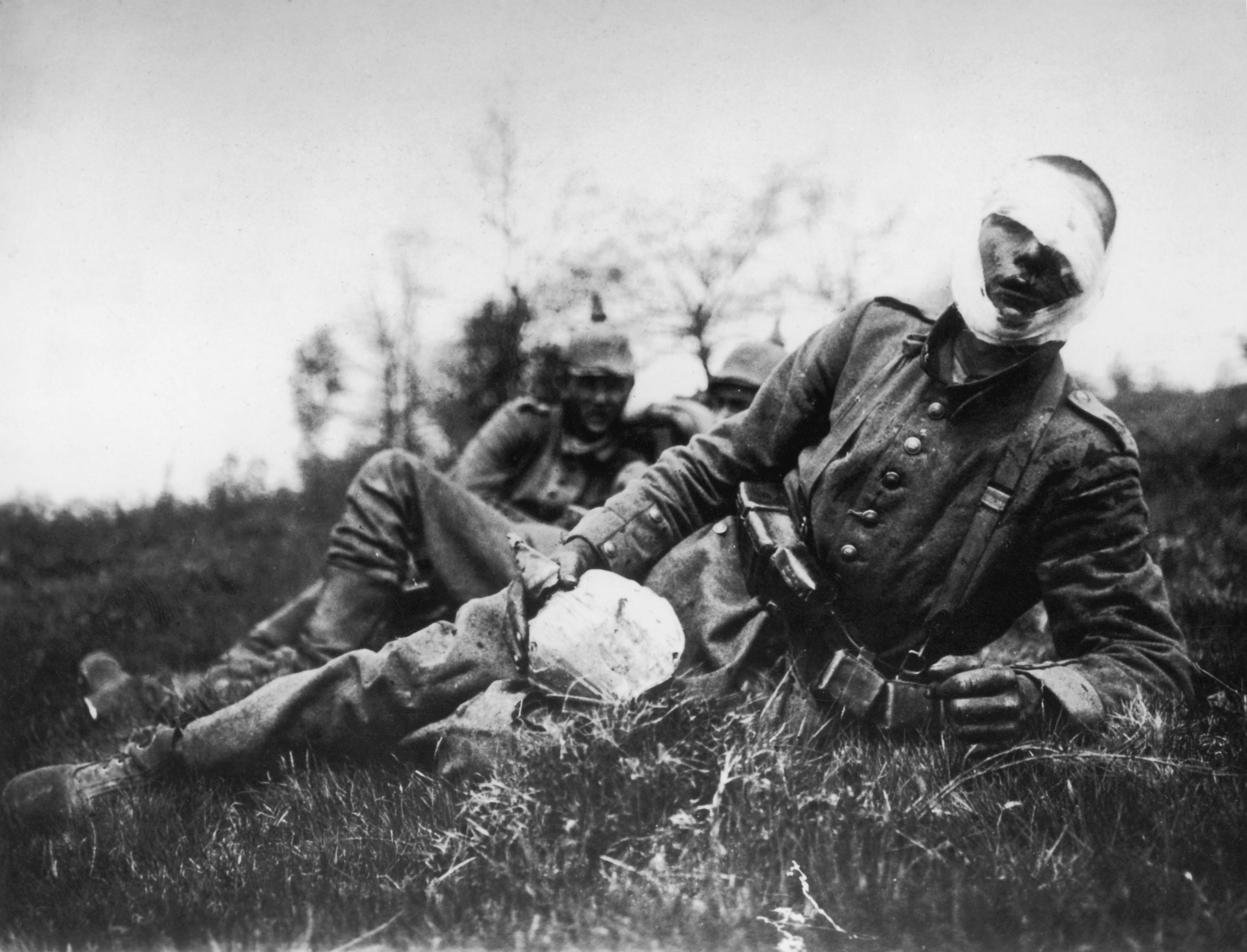 Первая мировая погибло. Раненые солдаты первой мировой войны. 1 Мировая война раненые русские солдаты. Раненый немецкий солдат 1941. Раненые солдаты 2 мировая война.