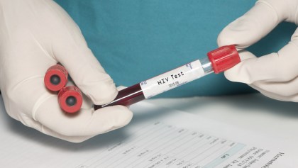 ¡Wow! Un paciente en Londres podría haberse curado de VIH; es el segundo en la historia
