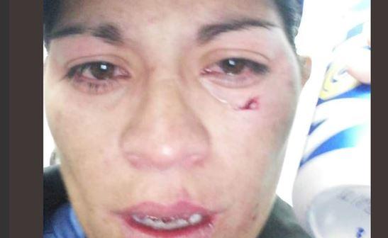 Por expulsar a un jugador, golpearon a árbitro mujer en una liga amateur