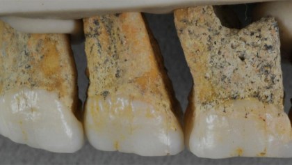 Hallan restos de nueva especie humana conocida como 'Homo luzonensis'