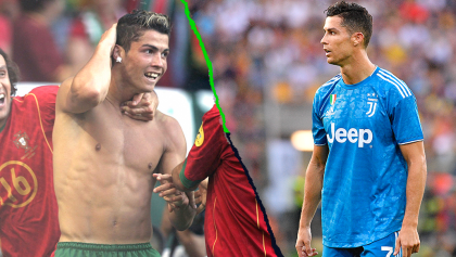 Las 5 cirugías plásticas a las que se habría sometido Cristiano Ronaldo