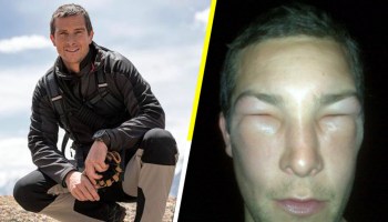 Parece que no es a prueba de todo: Bear Grylls casi muere al ser picado por una abeja