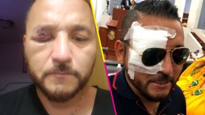 "El Mijis" fue atacado a pedradas al salir del Congreso de San Luis Potosí