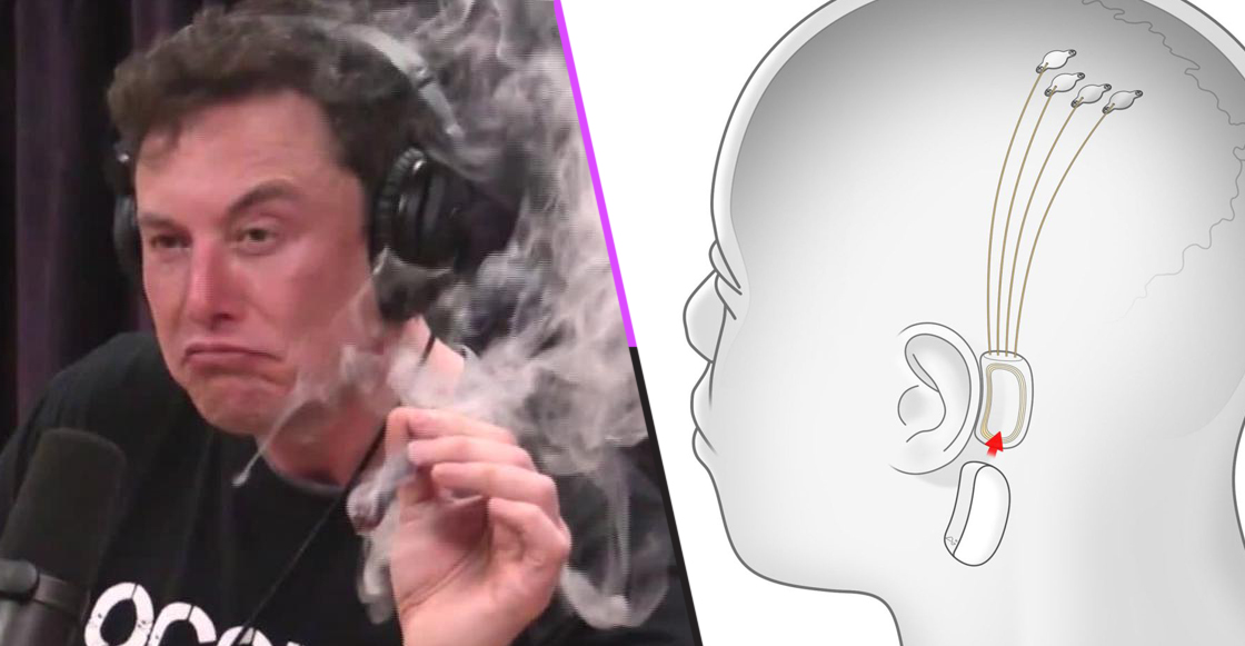 El Futuro Es Elon Musk Ahora Est Trabajando En Un Chip Cerebral Para Escuchar M Sica Y Curar