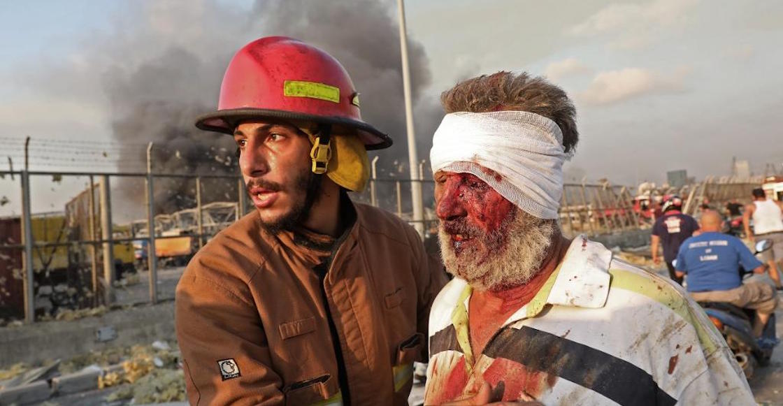 secuelas-hospitales-fotos-imagenes-explosion-beirut-heridos-libano-cuantos-01