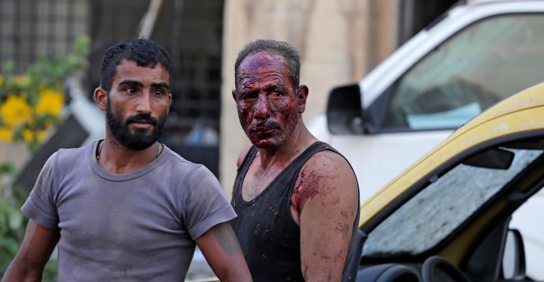 secuelas-hospitales-fotos-imagenes-explosion-beirut-heridos-libano-cuantos-04