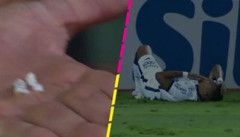 Pésimo día para un jugador del Corinthians: Sufrió un fuerte choque y perdió 4 dientes