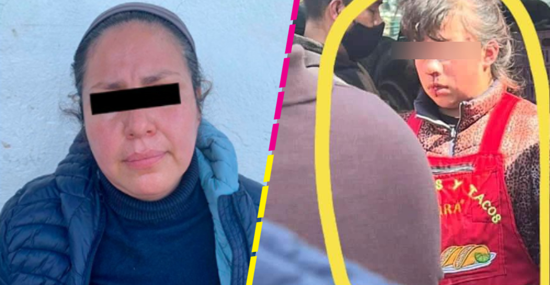 Mujer le rompió la nariz a una niña de 12 años por mirar a su esposo