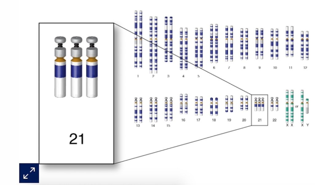 cromosoma-21-gautier-marthe
