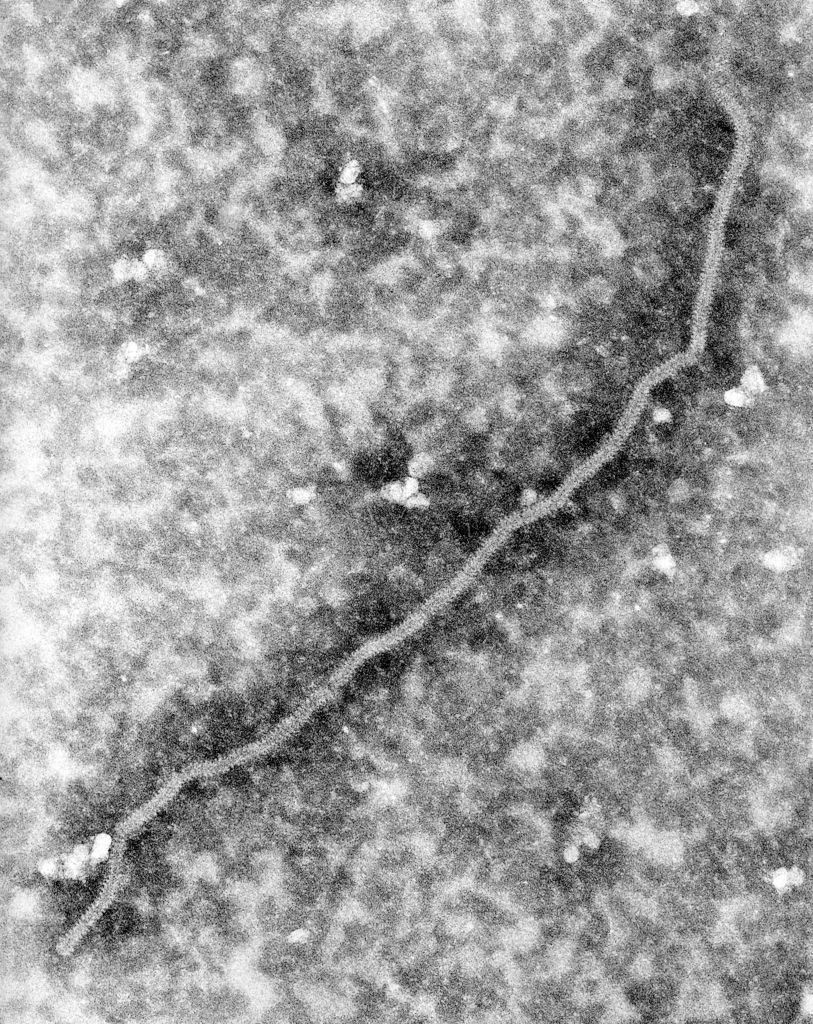 henipavirus-oms-virus