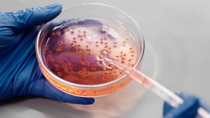 La bacteria carnívora que está provocando varios casos en Estados Unidos.