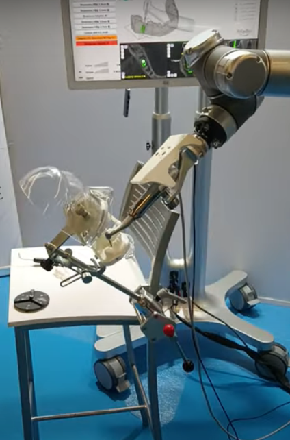 Yakebot, el primer robot dentista