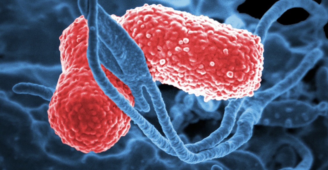 Bacteria Klebsiella Oxytoca en México: ¿Qué es, cuáles son los síntomas y tratamiento?