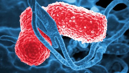 Bacteria Klebsiella Oxytoca en México: ¿Qué es, cuáles son los síntomas y tratamiento?